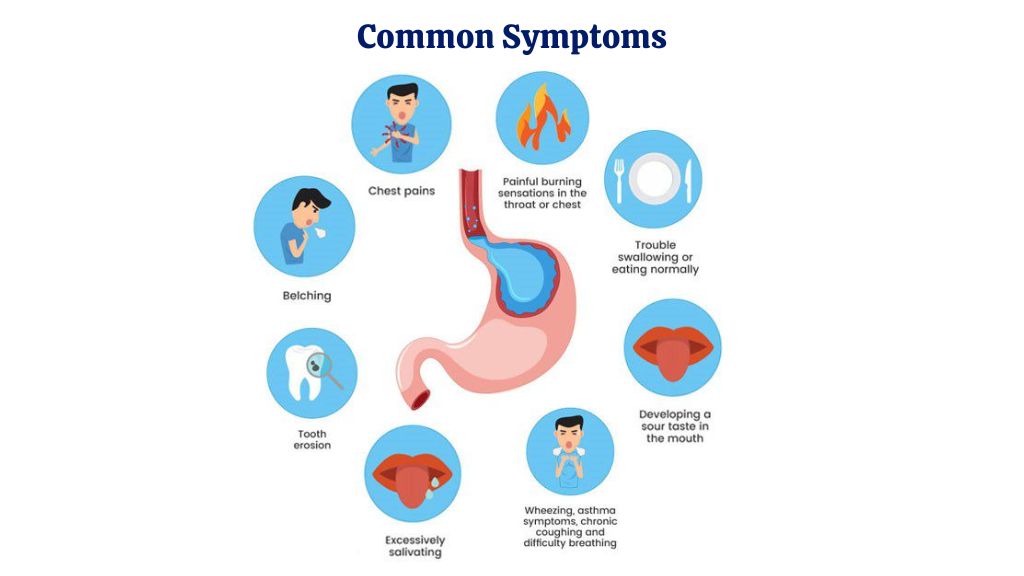 GERD Causes