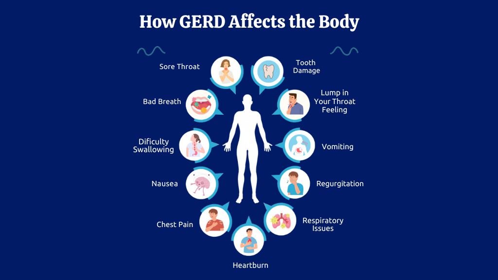 GERD Causes